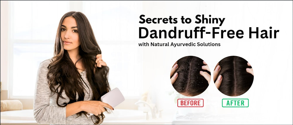 Secrets to Shiny, Dandruff-Free Hair with Natural Ayurvedic Solutions