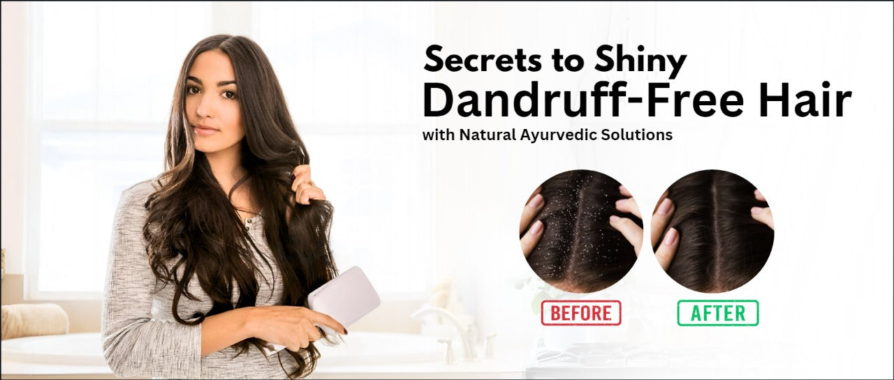 Secrets to Shiny, Dandruff-Free Hair with Natural Ayurvedic Solutions